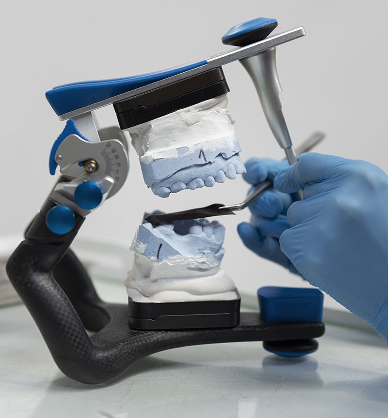 Chirurgia ricostruttiva ossea e gengivale pre-implantare